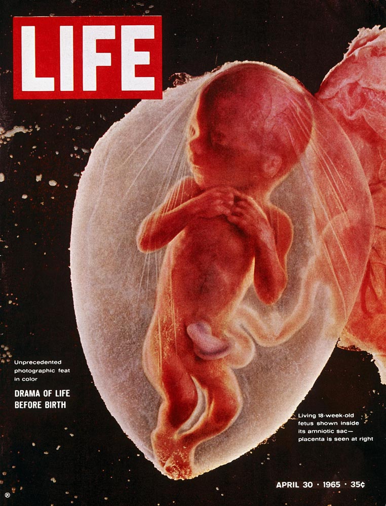 18 -week-old fetus shown inside amniotic sac. Placenta is seen at right, used on cover of LIFE 4-30-1965, w. logo & headline.
